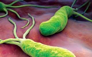 Бактерия Helicobacter Pylori, что это такое и как лечить?