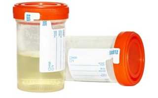 Повышенные эритроциты в моче: причины и лечение