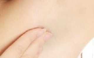 Воспаление и увеличение лимфоузлов под мышкой
