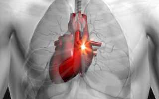 Учащенное сердцебиение: причины, диагностика и лечение