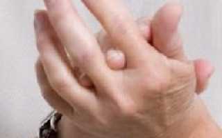 Что делать, когда немеют руки – причины и лечение