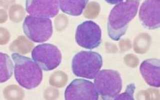 Почему лимфоциты в крови понижены, о чем это говорит?