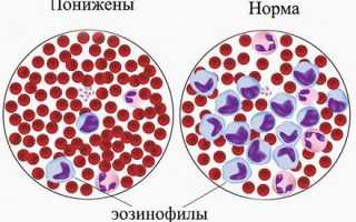 Почему в крови эозинофилы понижены, о чем это говорит?
