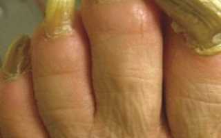 Как выглядят ногти