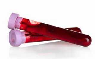 Почему повышены лимфоциты в крови, что это значит?