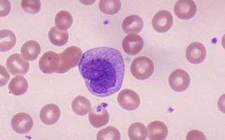 Почему в крови моноциты понижены, о чем это говорит?