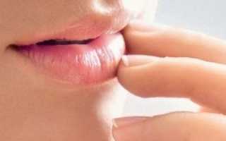 Трещины в уголках рта: причины и лечение у взрослых