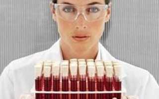 Повышенный гемоглобин: причины у женщин и мужчин