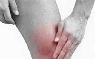 Почему возникает боль в колене при сгибании или разгибании