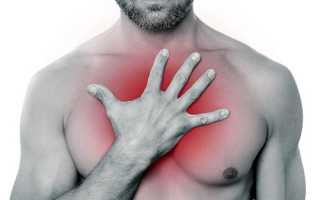 О чем говорит боль в грудине посередине: причины и диагностика
