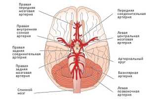 Гипоплазия правой позвоночной артерии