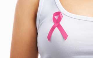Как определяется рак груди