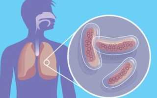 Туберкулез – симптомы и первые признаки