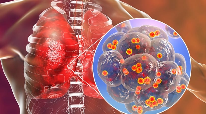 Все про коронавирус: откуда он взялся и что представляет