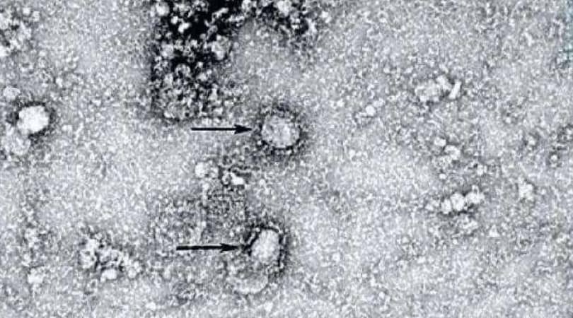 В чем сходство ВИЧ и коронавируса?