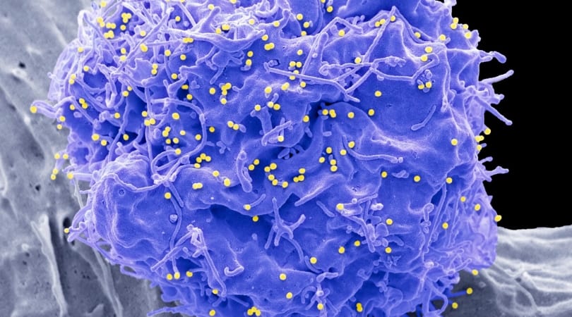 В чем сходство ВИЧ и коронавируса?