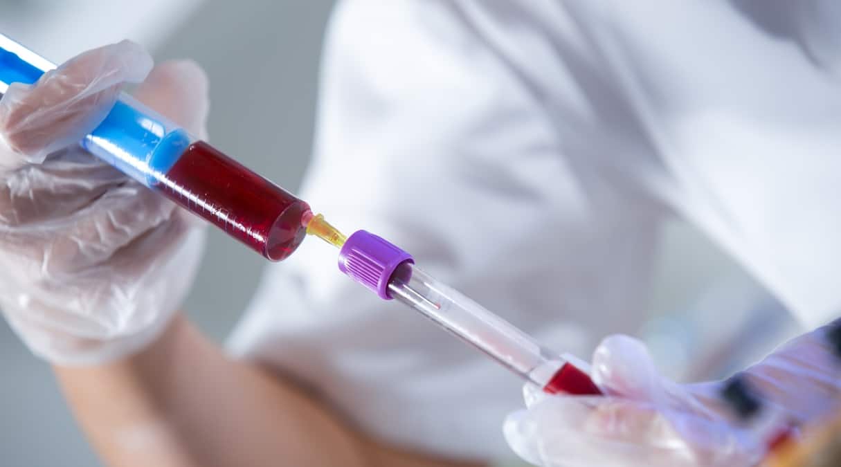 Что значит положительный ВИЧ?