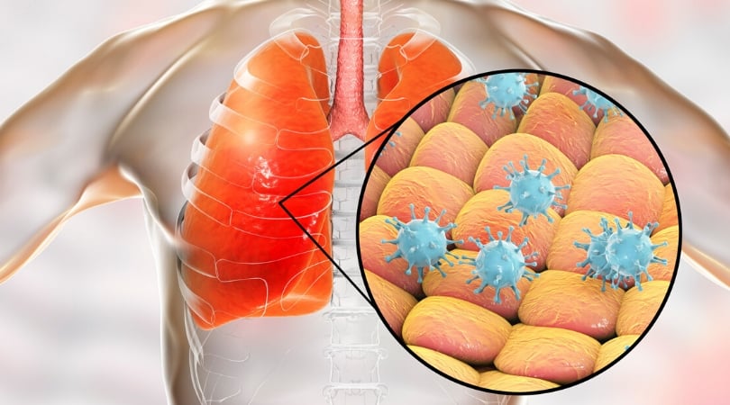 Коронавирус: мифы и правда о новом заболевании