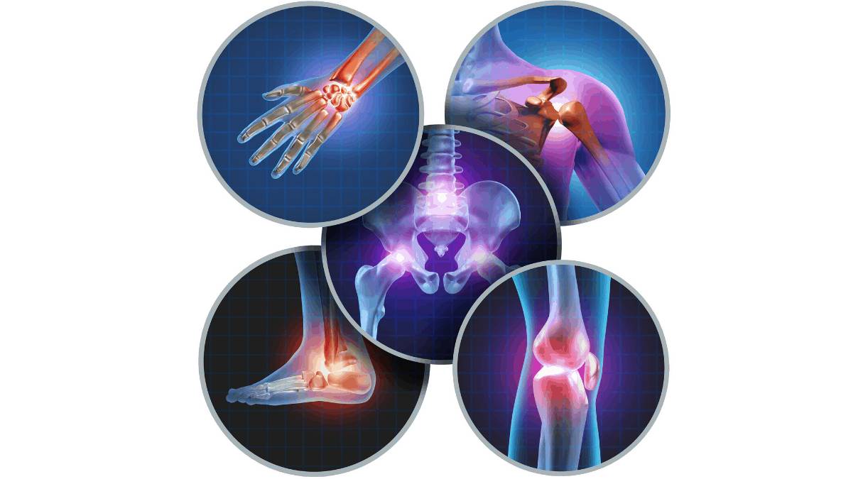 Боли в суставах Типы болей в суставах