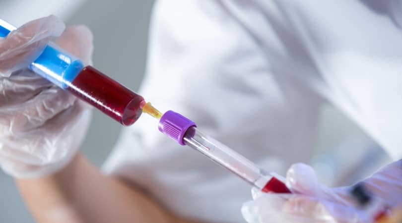 ВИЧ и СПИД: в чем разница?