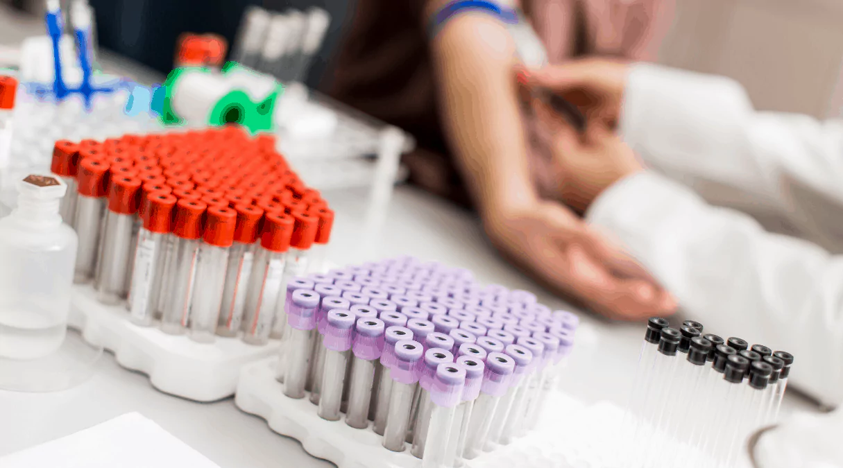 Анализ где сдавать Где сдавать анализы на антитела к HCV