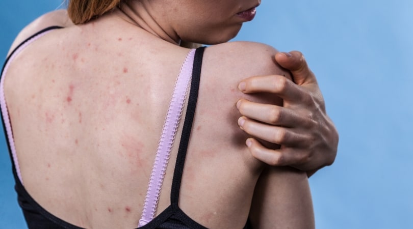 Симптомы ВИЧ у женщин