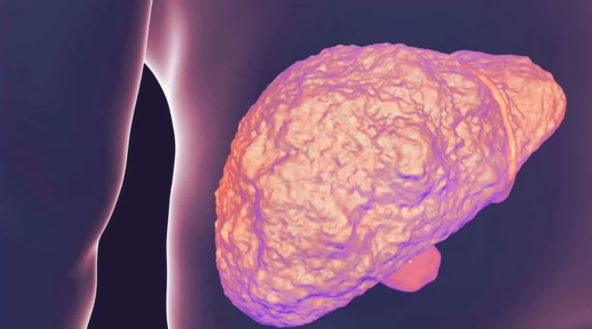 Последствия гепатита С: чем опасна эта болезнь