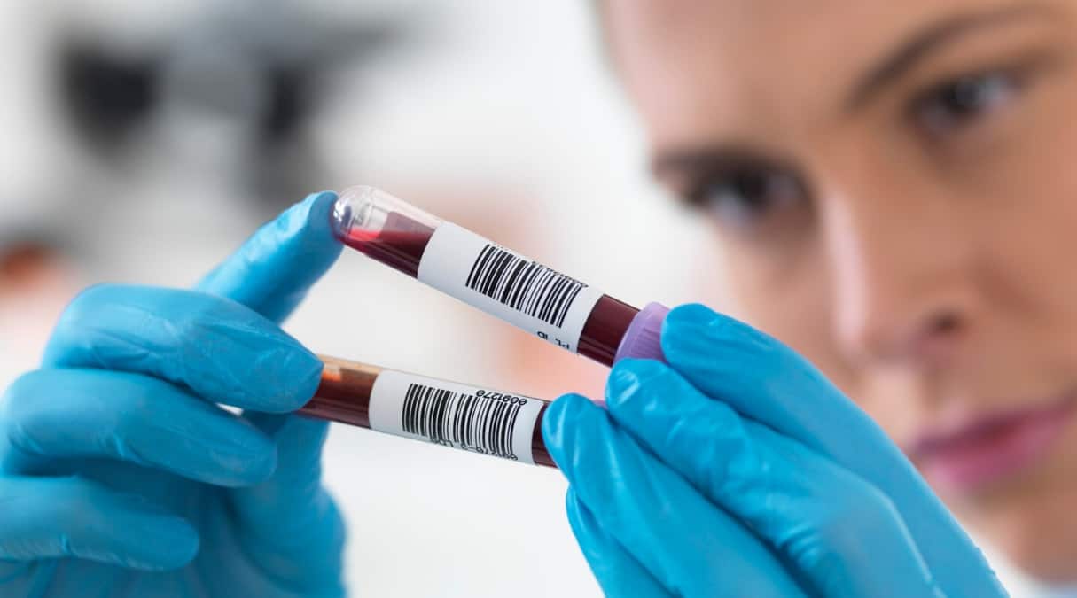 Расшифровка анализов на гепатит