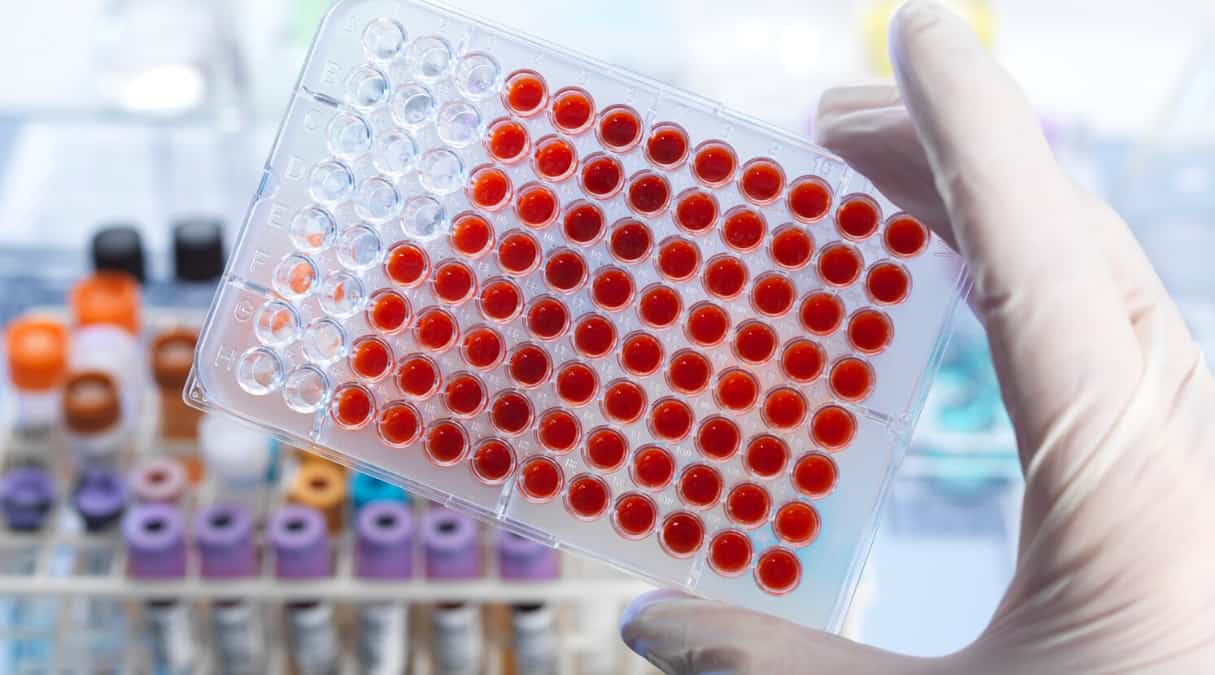 Расшифровка анализов на гепатит