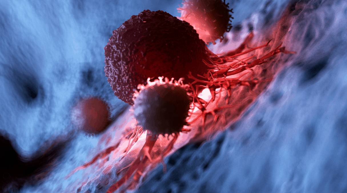 Как понять, что у тебя рак? Первые признаки онкологии