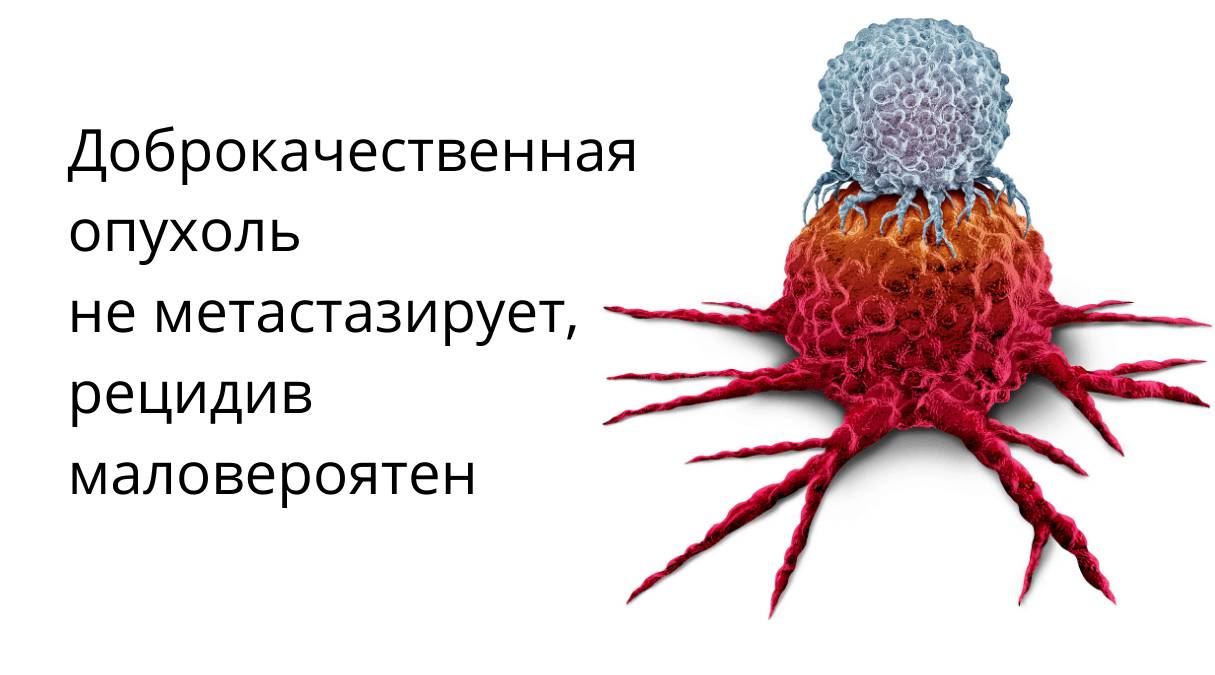 Доброкачественная и злокачественная опухоли