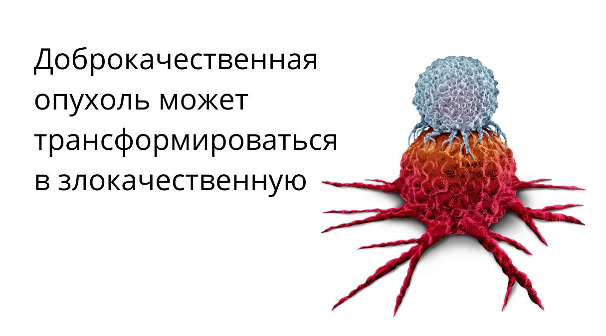 Доброкачественная и злокачественная опухоли