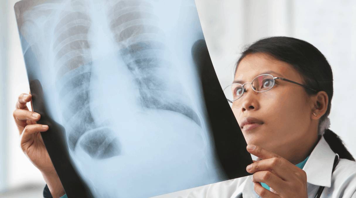 Стадии рака: от начальной до терминальной