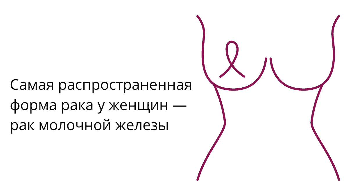 Виды рака: классификация онкологических заболеваний