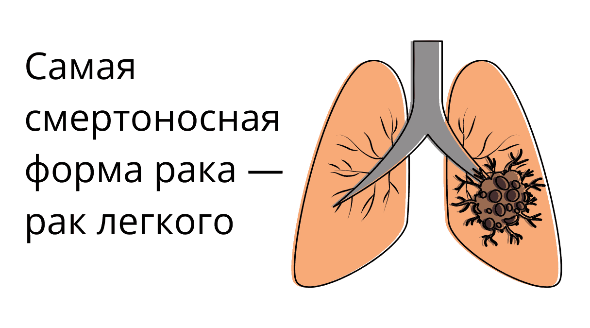 Виды рака: классификация онкологических заболеваний