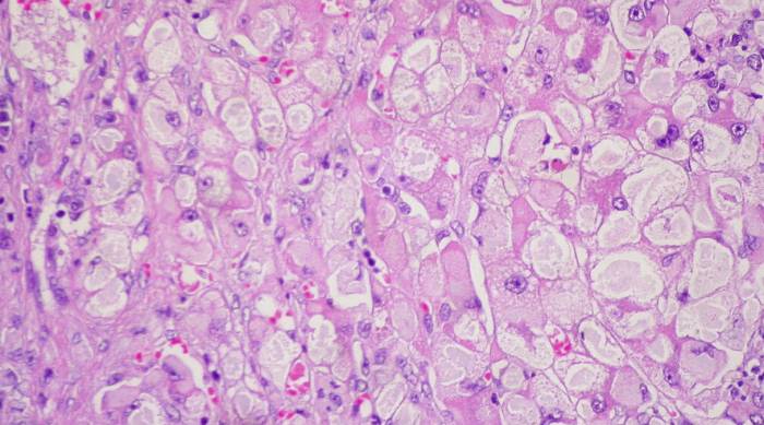 Клетка печени и ее роль в физиологии железы