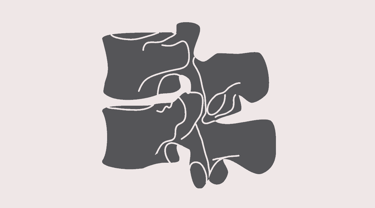 Боли в правом боку: что находится в правом подреберье?