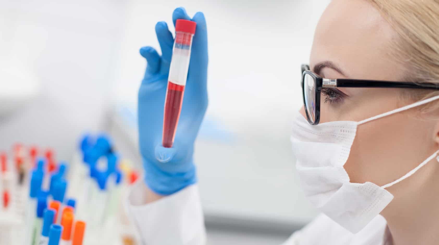 Расшифровка анализа на ВГС