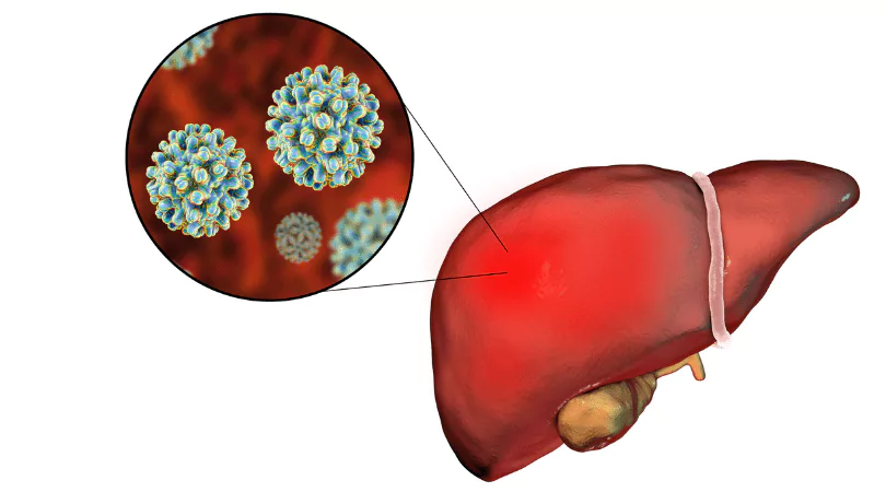 вирусный гепатит вирус гепатита С