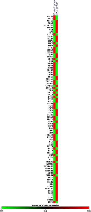<strong>Рисунок 3.</strong> Кластерграмма показывает сравнение уровня экспрессии тестируемых генов в CD133+ клетках среди пациентов в группе с ГЦК по отношению к контрольной группе. Рисунок 3. Кластерграмма показывает сравнение уровня экспрессии тестируемых генов в CD133+ клетках среди пациентов в группе с ГЦК по отношению к контрольной группе.