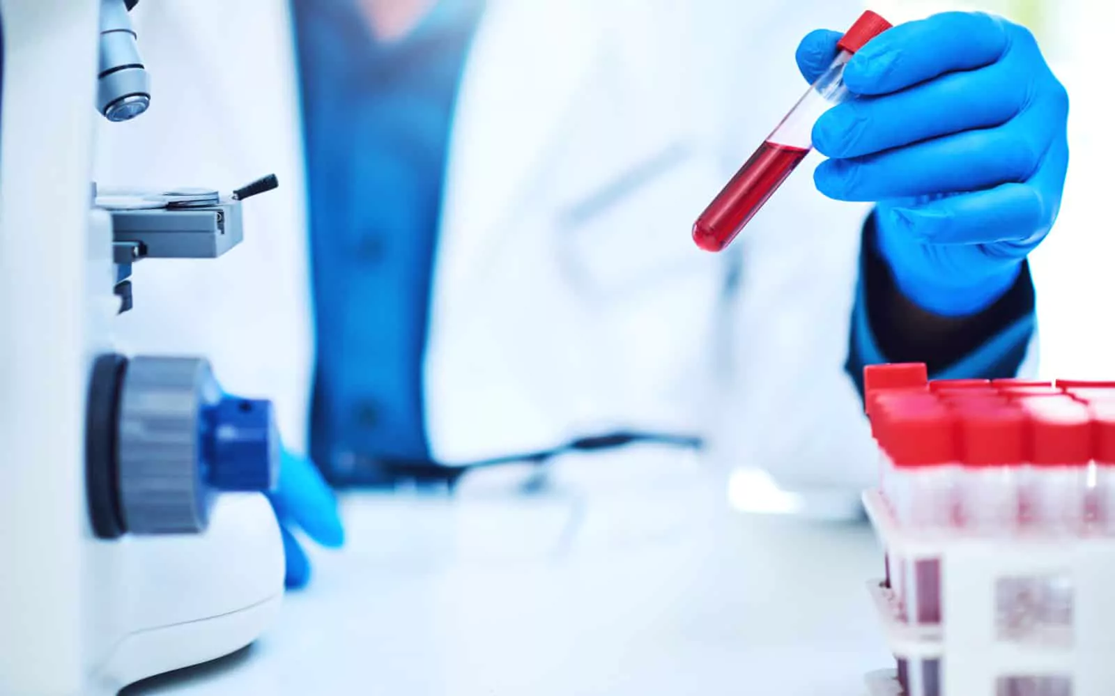 Анализ крови на маркеры вирусных гепатитов В и С