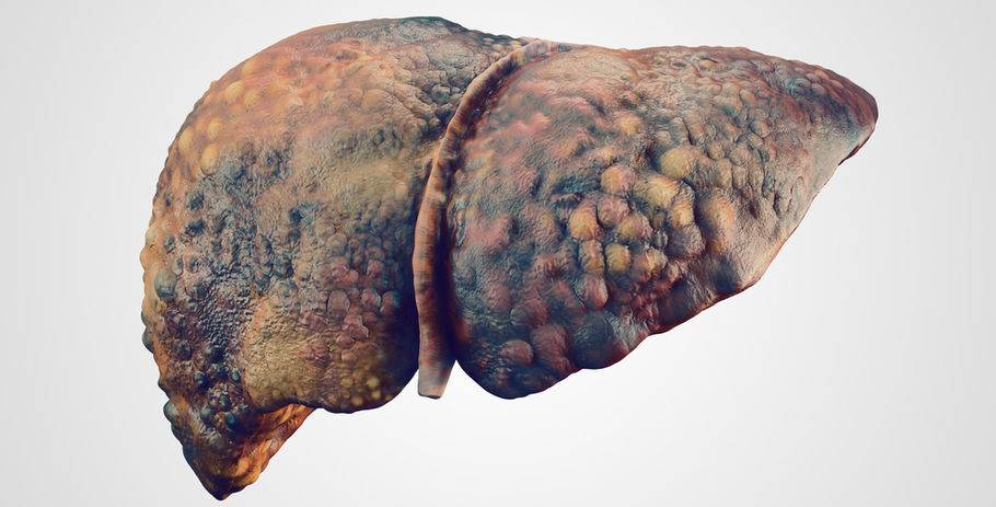 фиброз печени