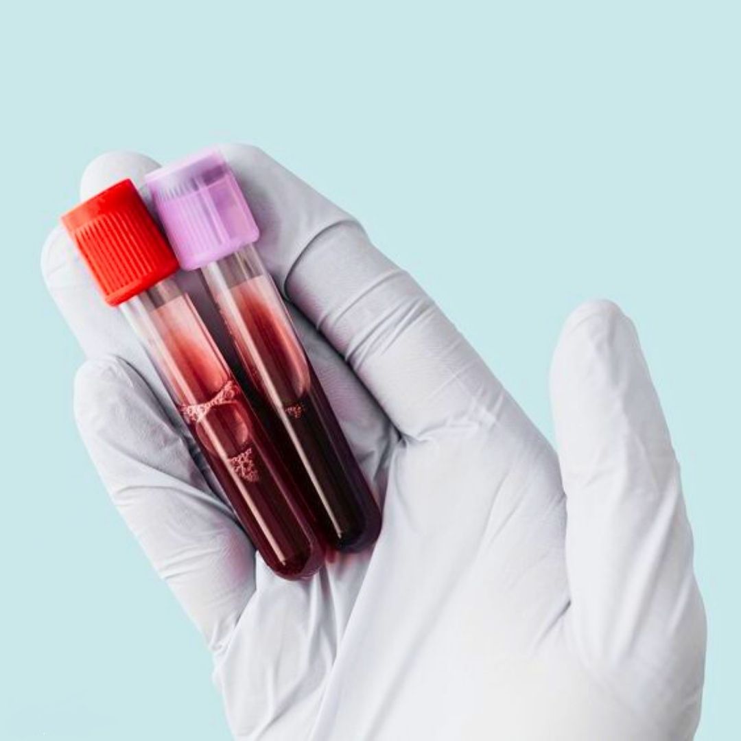 3 генотип вирусного гепатита С: особенности и лечение