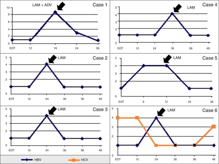 <strong>Рисунок 1</strong>. Профили сывороточной ВГС-РНК и ВГВ-ДНК у шести пациентов с реактивацией ВГВ во время наблюдения после успешной терапии ВГС. Уровни ВГС-РНК и ВГВ-ДНК выражены как log10 МЕ/мл, а нижний предел обнаружения обоих тестов составляет 50 МЕ/мл. <br />Сокращения и аббревиатуры: EOT — окончание терапии гепатита С; LAM — ламивудин; ADV — адефовир; Case — наблюдаемый случай. Профили сывороточной ВГС-РНК и ВГВ-ДНК у шести пациентов с реактивацией ВГВ во время наблюдения после успешной терапии ВГС.